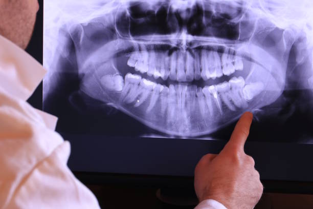 Best Urgent Tooth Repair  in Windom, MN